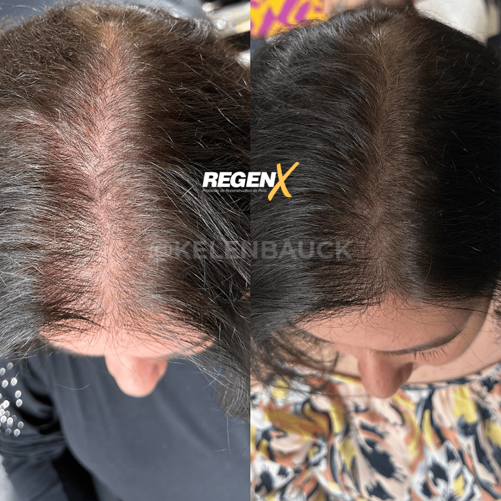 2-regenx-cheveux