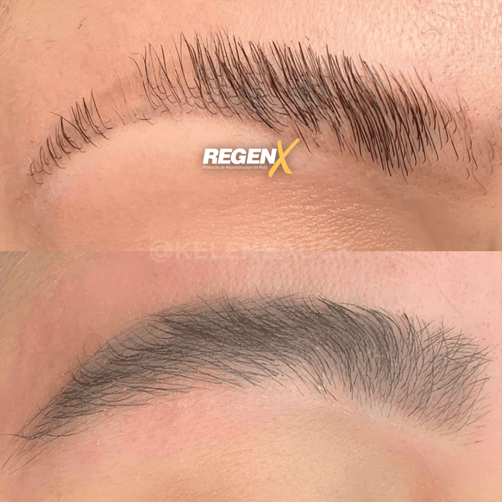 1-regenx-sourcil