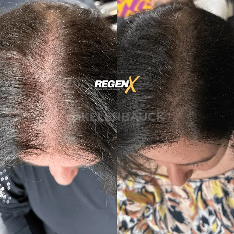 repousse capillaire femme